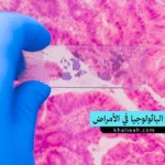 دور الباثولوجيا