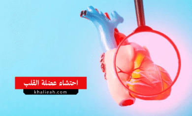 احتشاء عضلة القلب