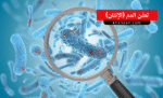 تعفن الدم (الإنتان)
