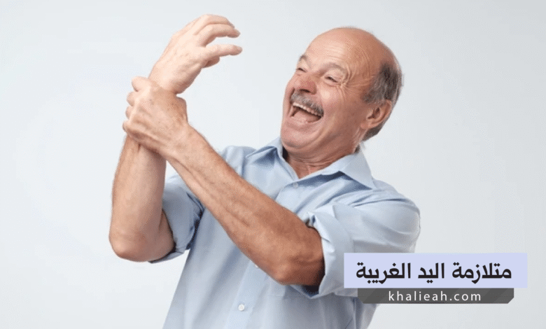 متلازمة اليد الغريبة
