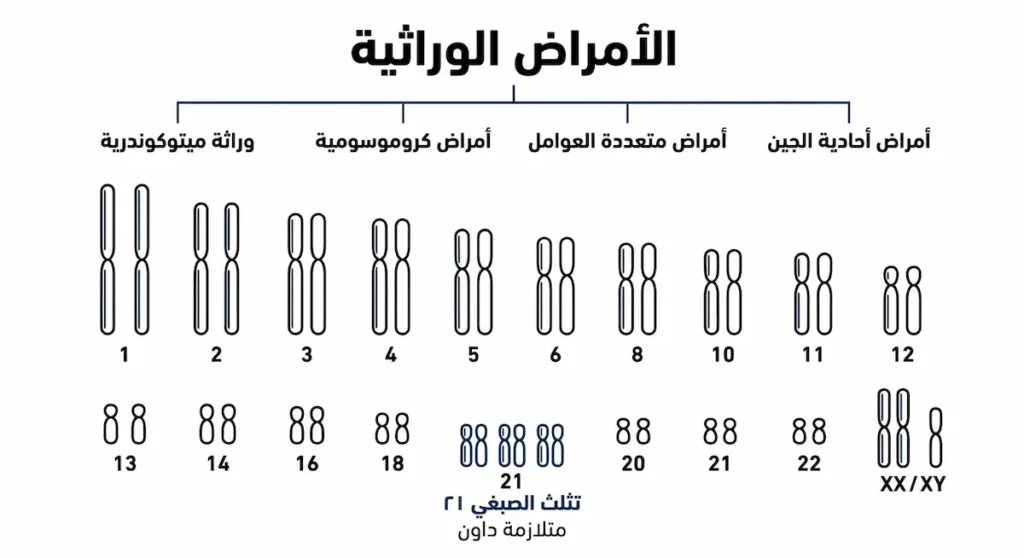 إنفوجرافيك يصنف الأمراض الوراثية ويعرض كاريотип يوضح تثلث الصبغي ٢١.
