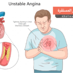 الذبحة غير المستقرة