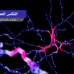 التنكس العصبي