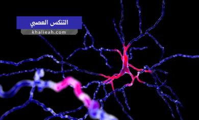 التنكس العصبي