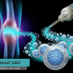 الخلايا الجذعية