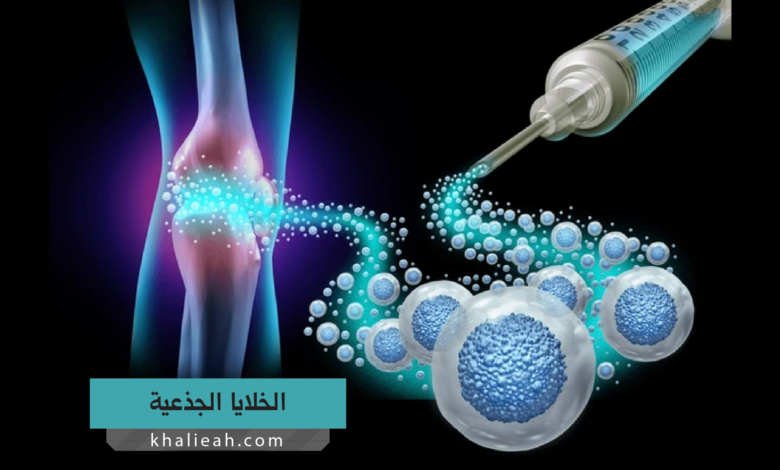 الخلايا الجذعية