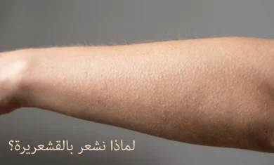 ذراع بشرية تظهر عليها نتوءات القشعريرة مع شعيرات منتصبة تحت إضاءة طبيعية