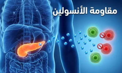 رسم توضيحي طبي يُظهر البنكرياس وهو يُفرز الأنسولين نحو خلايا الجسم، مع توضيح الخلايا المقاومة والخلايا المستجيبة
