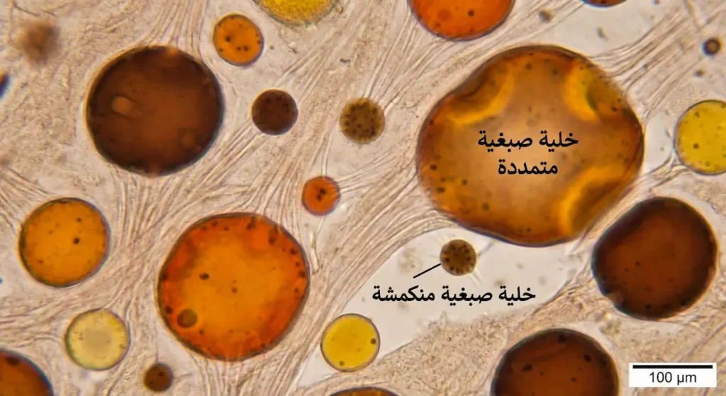 صورة مجهرية توضح الخلايا الصبغية المتمددة والمنكمشة في جلد الأخطبوط المسؤولة عن التمويه