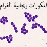 صورة مجهرية واقعية لمكورات إيجابية الغرام بنفسجية اللون مرتّبة في عناقيد وسلاسل بعد صبغة جرام