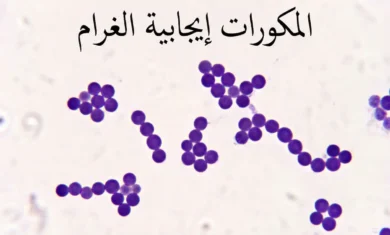 صورة مجهرية واقعية لمكورات إيجابية الغرام بنفسجية اللون مرتّبة في عناقيد وسلاسل بعد صبغة جرام