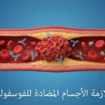 رسم توضيحي طبي يُظهر وعاءً دموياً مع تكوّن جلطة وأجسام مضادة تستهدف جداره، مع عنوان متلازمة الأجسام المضادة للفوسفولبيد