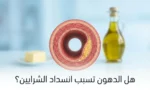 غلاف مقال طبي يُظهر مقطعاً عرضياً لشريان بشري مع لويحة دهنية جزئية وأطعمة متنوعة في الخلفية مع عنوان هل الدهون تسبب انسداد الشرايين