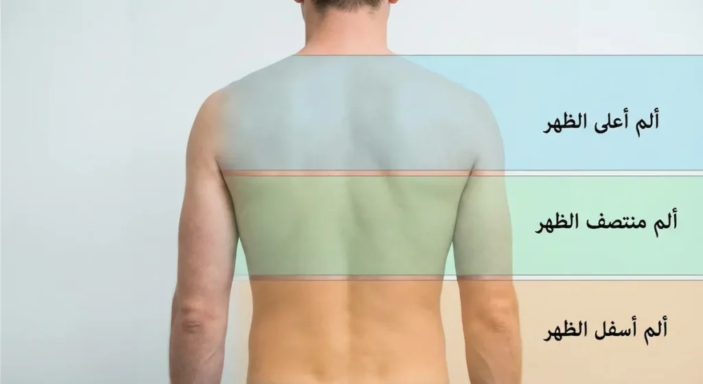 ظهر شخص من الخلف مقسّم إلى ثلاث مناطق ملونة توضح مواقع ألم أعلى الظهر ومنتصف الظهر وأسفل الظهر