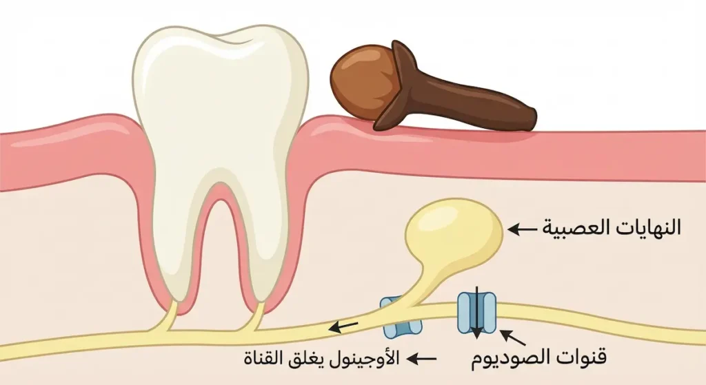  رسم توضيحي لمقطع جانبي لضرس ولثة يوضح كيف يغلق الأوجينول الموجود في القرنفل قنوات الصوديوم في النهايات العصبية مما يمنع وصول إشارة الألم