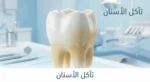 صورة غلاف تُظهر سناً بشرياً يوضح الفرق بين المينا السليمة اللامعة والمينا المتآكلة المصفرة مع كلمة تآكل الأسنان