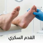 طبيب يرتدي قفازاً طبياً يفحص قدم مريض سكري تظهر عليها علامات جفاف واحمرار مبكر في عيادة طبية مضاءة