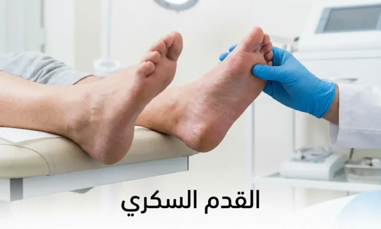 طبيب يرتدي قفازاً طبياً يفحص قدم مريض سكري تظهر عليها علامات جفاف واحمرار مبكر في عيادة طبية مضاءة