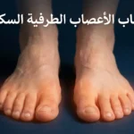صورة غلاف تُظهر قدمين حافيتين مع توهج أحمر حول الأصابع يرمز إلى ألم التهاب الأعصاب الطرفية السكري وعليها عنوان المقال باللغة العربية