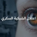 صورة غلاف تُظهر عيناً بشرية عن قرب مع انعكاس الشبكية في الحدقة وعنوان اعتلال الشبكية السكري
