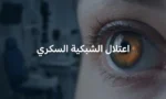 صورة غلاف تُظهر عيناً بشرية عن قرب مع انعكاس الشبكية في الحدقة وعنوان اعتلال الشبكية السكري
