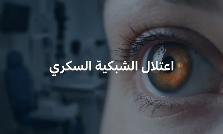 صورة غلاف تُظهر عيناً بشرية عن قرب مع انعكاس الشبكية في الحدقة وعنوان اعتلال الشبكية السكري