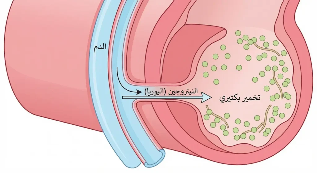 رسم توضيحي طبي مبسط يُظهر آلية عمل الصمغ العربي في سحب النيتروجين واليوريا من الدم عبر جدار القولون بواسطة التخمير البكتيري للألياف