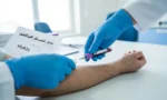 يد فنّي مختبر يرتدي قفازاً طبياً يسحب عينة دم من ذراع شخص بالغ مع ورقة نتيجة تحليل مكتوب عليها تحليل السكر التراكمي HbA1c