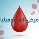 غلاف مقال طبي يعرض قطرة دم حمراء مع خلايا دم في الخلفية وعنوان مرض الهيموفيليا بالعربية