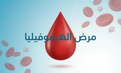 غلاف مقال طبي يعرض قطرة دم حمراء مع خلايا دم في الخلفية وعنوان مرض الهيموفيليا بالعربية