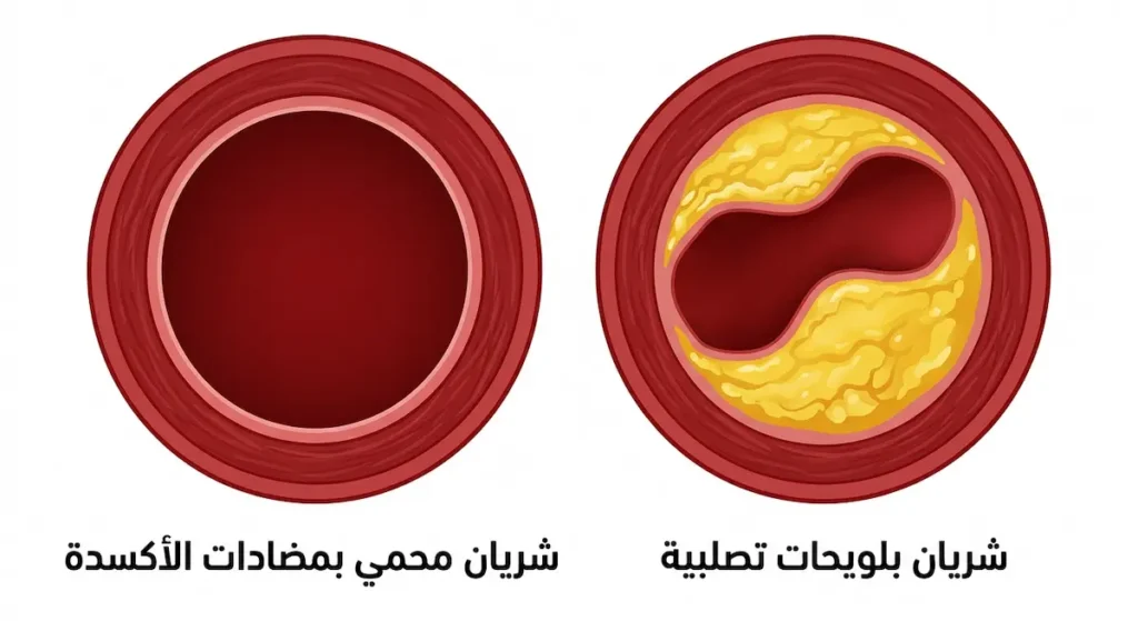رسم توضيحي يُقارن بين مقطع عرضي لشريان به لويحات تصلبية وشريان صحي محمي بمضادات الأكسدة الموجودة في الكركديه