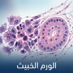 صورة غلاف طبية تُظهر مقارنة مجهرية بين خلايا طبيعية منتظمة وخلايا ورم خبيث غير منتظمة مع عنوان الورم الخبيث