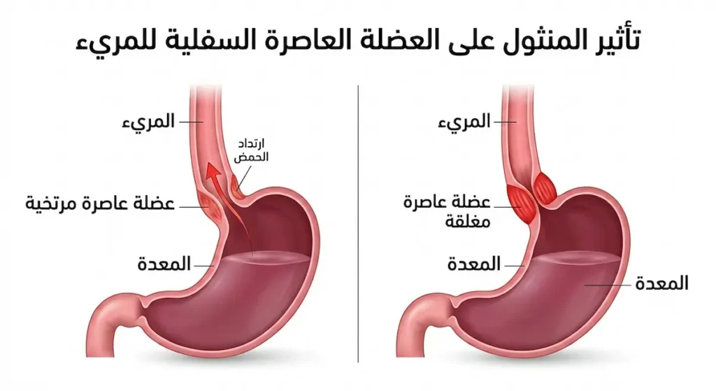  رسم توضيحي يوضح كيف يُرخي المنثول العضلة العاصرة السفلية للمريء مسبباً ارتداد حمض المعدة