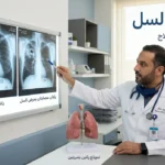 غلاف مقال طبي يُظهر طبيباً يفحص صورة أشعة سينية للصدر مع عنوان مرض السل