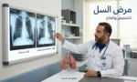 غلاف مقال طبي يُظهر طبيباً يفحص صورة أشعة سينية للصدر مع عنوان مرض السل