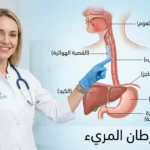صورة غلاف توضيحية لمقال سرطان المريء تُظهر تشريح المريء مع طبيبة تشير إليه