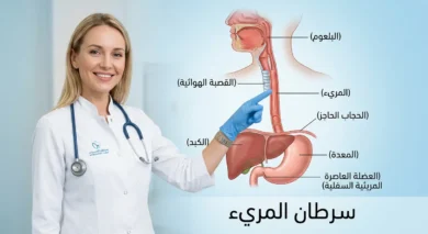 صورة غلاف توضيحية لمقال سرطان المريء تُظهر تشريح المريء مع طبيبة تشير إليه