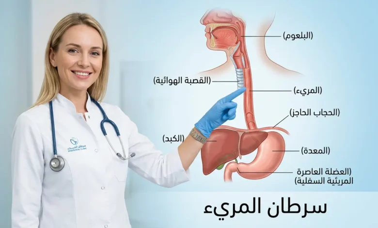 صورة غلاف توضيحية لمقال سرطان المريء تُظهر تشريح المريء مع طبيبة تشير إليه