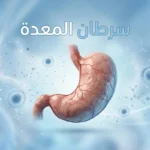 صورة غلاف توضيحية تُظهر معدة بشرية ثلاثية الأبعاد مع عنوان سرطان المعدة بالعربية