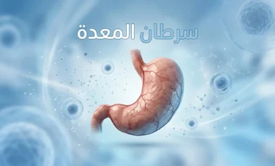 صورة غلاف توضيحية تُظهر معدة بشرية ثلاثية الأبعاد مع عنوان سرطان المعدة بالعربية