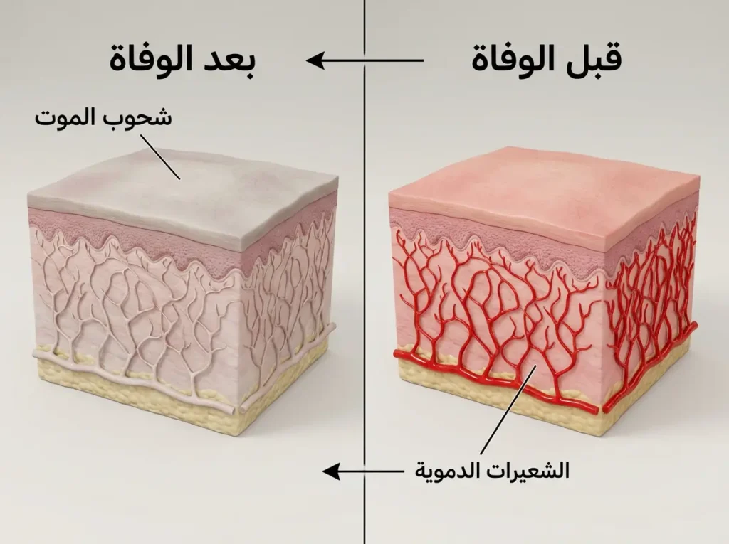 مقارنة علمية بين الجلد قبل الوفاة وبعدها توضح اختفاء الدم السطحي وحدوث شحوب الموت